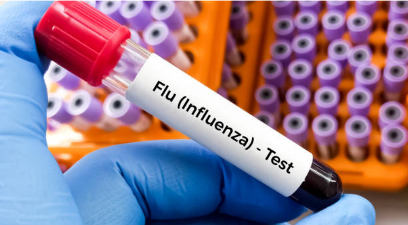 Influenza test